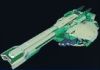 Plasma Discharger